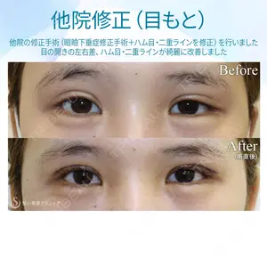 聖心美容クリニック 銀座院 牧野 陽二郎医師の症例