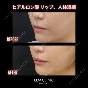 美容皮膚科エルムクリニック 福岡院 菊池 寛医師の症例
