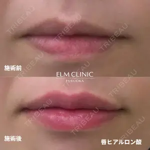 美容皮膚科エルムクリニック 福岡院 早川 祐輔医師の症例