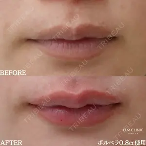 美容皮膚科エルムクリニック 福岡院 早川 祐輔医師の症例