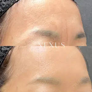 NEXUS CLINICの症例