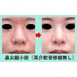 WOM CLINIC GINZA （ワム クリニック ギンザ） 佐々木 和司医師の症例
