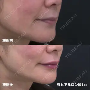 美容皮膚科エルムクリニック 福岡院 早川 祐輔医師の症例