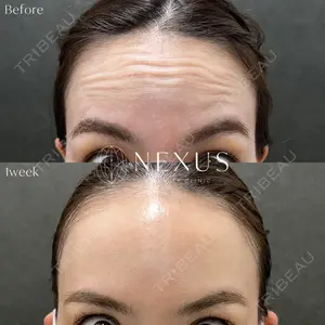 NEXUS CLINICの症例