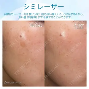聖心美容クリニック 熱海院 小林 美幸（皮膚科）医師の症例