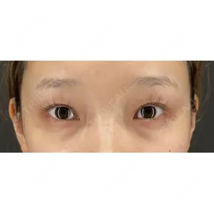 HAAB×DREAM BEAUTY CLINIC 大阪梅田院 鈴木 馨斗医師の症例