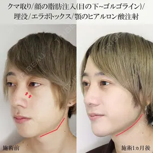 銀座TAクリニック 山田 真里江医師の症例