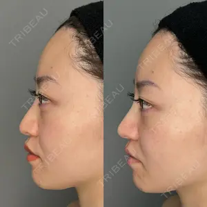 ASTRA BEAUTY CLINIC 塩満 惠子医師の症例