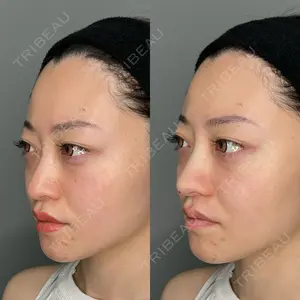 ASTRA BEAUTY CLINIC 塩満 惠子医師の症例