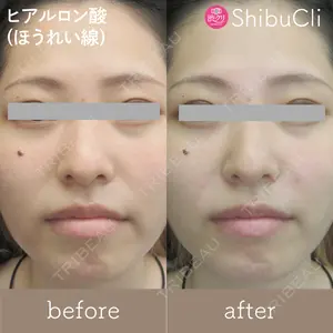 渋谷美容外科クリニック 池袋院 峯岸 季清医師の症例