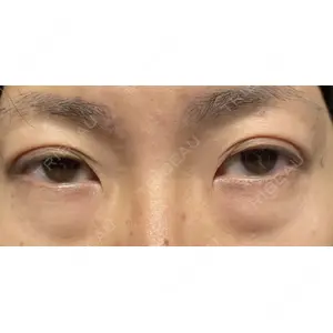 X CLINIC 福岡天神院の症例
