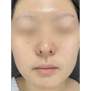 X CLINIC 銀座院 程 璐医師の症例