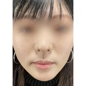 X CLINIC 銀座院 程 璐医師の症例