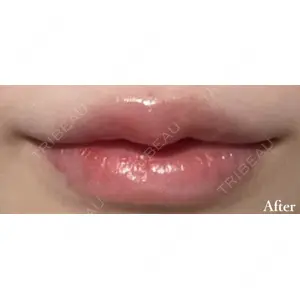 X CLINIC 銀座院 程 璐医師の症例