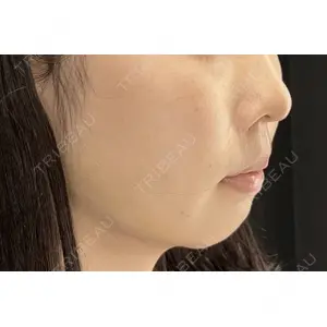 HAAB×DREAM BEAUTY CLINIC 大阪梅田院 鈴木 馨斗医師の症例