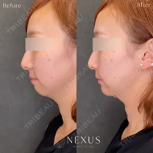 NEXUS CLINICの症例