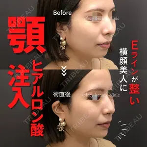 ロレシー美容クリニック 心斎橋駅前院 福留院長医師の症例