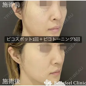 Bellefeel Clinic 代官山 兵藤 秀忠 医師の症例