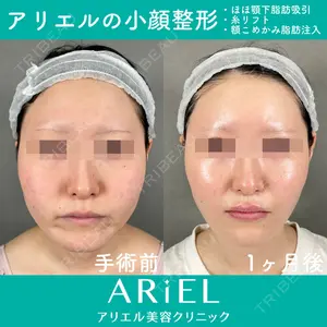 アリエル美容クリニック 大宮院 鈴木　桂介医師の症例
