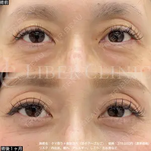 LIBER CLINIC 矢橋 洋一郎医師の症例