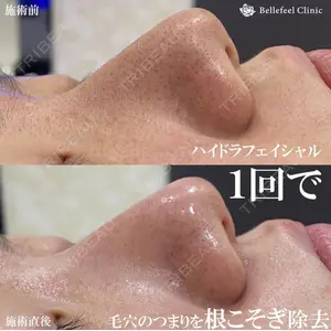 Bellefeel Clinic 代官山 兵藤 秀忠 医師の症例