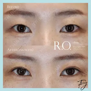 R.O.clinicの症例