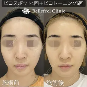 Bellefeel Clinic 代官山 兵藤 秀忠 医師の症例