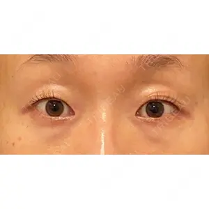 Wi Clinic（ウィ クリニック） 吉祥寺院の症例