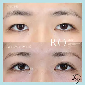 R.O.clinicの症例