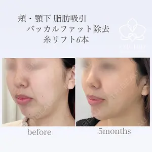 オーキッド美容クリニック東京御徒町 西浦 蘭子医師の症例