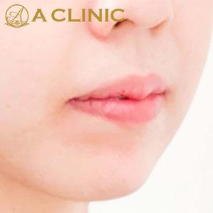 A CLINIC（エークリニック） 横浜院の症例