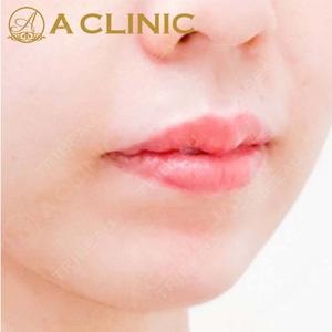 A CLINIC（エークリニック） 横浜院の症例