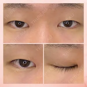 東京BELLEZZAクリニックの症例