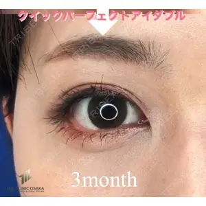 MIL CLINIC OSAKA 岩脇 槙佑医師の症例