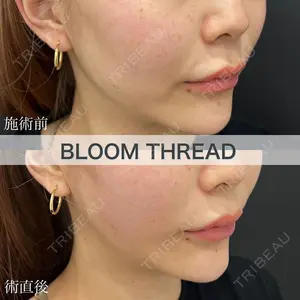 ブルームクリニック（BLOOM CLINIC） 大西 雅樹医師の症例