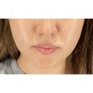 HAAB×DREAM BEAUTY CLINIC 大阪梅田院 鈴木 馨斗医師の症例