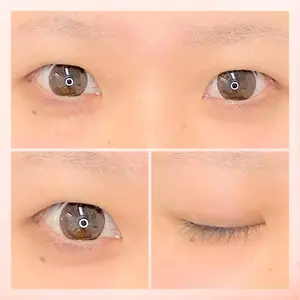 東京BELLEZZAクリニックの症例