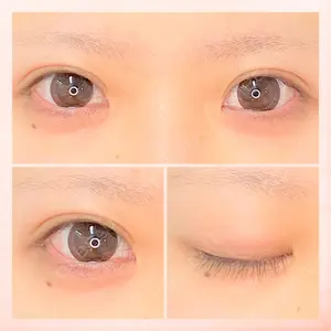 東京BELLEZZAクリニックの症例