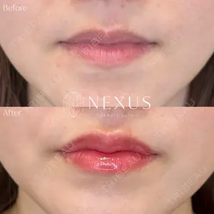 NEXUS CLINICの症例