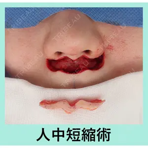 WOM CLINIC GINZA （ワム クリニック ギンザ） 佐々木 和司医師の症例