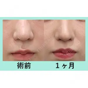 WOM CLINIC GINZA （ワム クリニック ギンザ） 佐々木 和司医師の症例