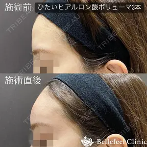 Bellefeel Clinic 代官山 兵藤 秀忠 医師の症例