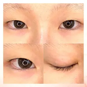 東京BELLEZZAクリニックの症例