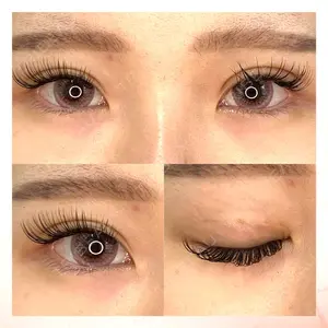 東京BELLEZZAクリニックの症例