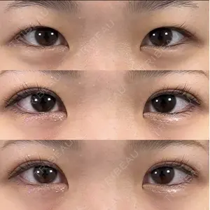 BELINDA CLINIC（ベリンダクリニック）新宿院 井上 真梨子医師の症例
