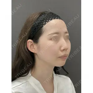 LOCHIC CLINIC GINZA【ロシッククリニック銀座】 小野 准平医師の症例