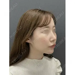 LOCHIC CLINIC GINZA【ロシッククリニック銀座】 小野 准平医師の症例