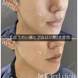 Bellefeel Clinic 代官山 兵藤 秀忠 医師の症例