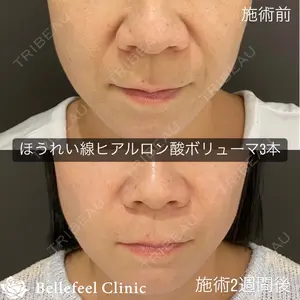 Bellefeel Clinic 代官山 兵藤 秀忠 医師の症例