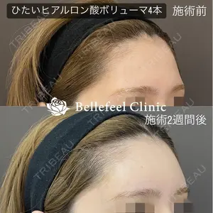 Bellefeel Clinic 代官山 兵藤 秀忠 医師の症例